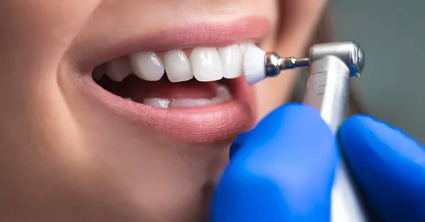Diş Törpüleme Nedir ve Kimler Bu İşleme İhtiyaç Duyar?