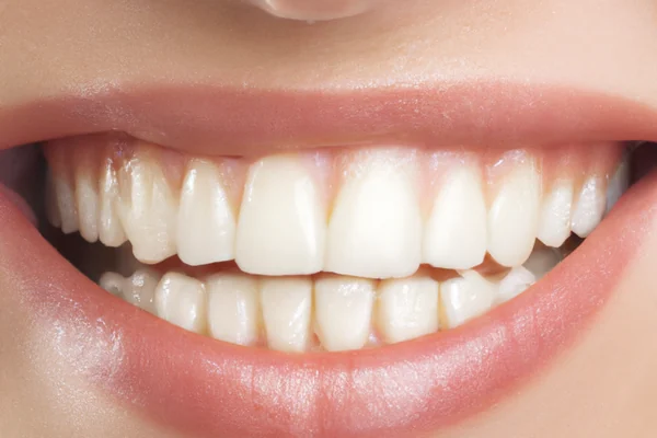 Gummy Smile (Dişeti Gülümsemesi) Nedir? Nedenleri ve Tedavi Yaklaşımları