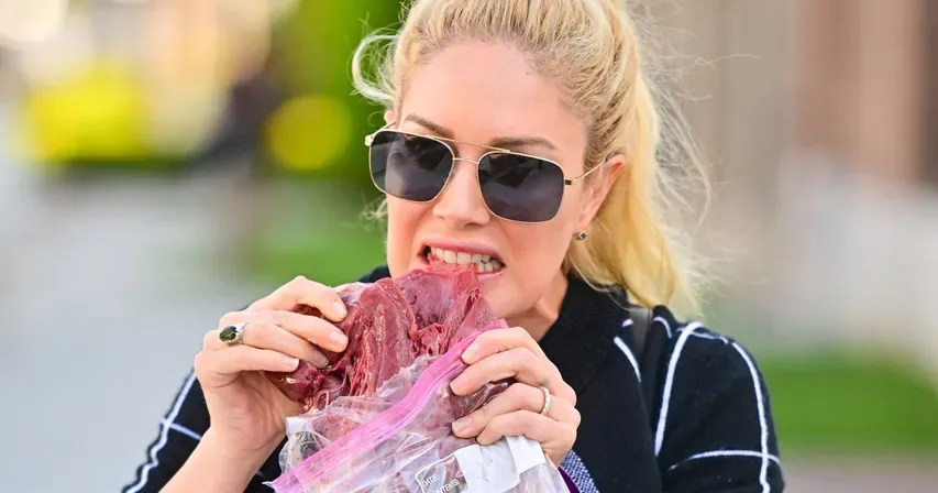 Heidi Montag Dişleri - Öncesi ve Sonrası