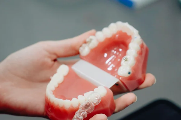 Pekiştirme (Retainer) Nedir? Ortodonti Sonrası Neden Önemli?