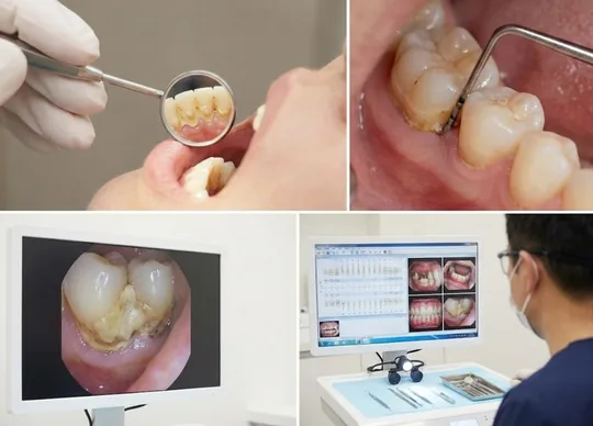 Klinik Değerlendirme ve Teşhis
